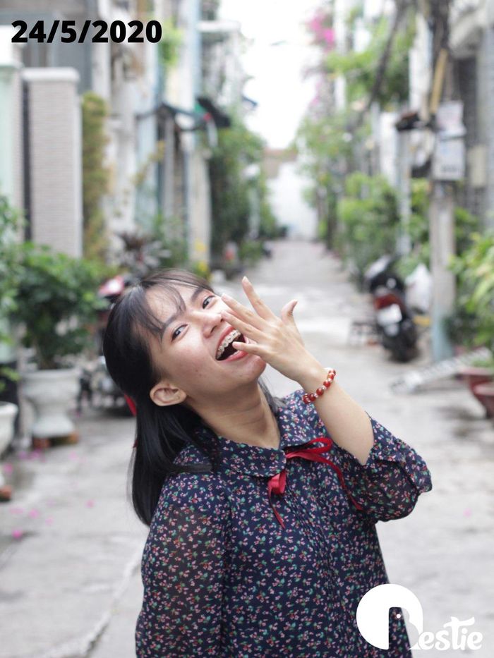 Chi 30 triệu niềng răng và 40 triệu mổ cận, cô gái lột xác ngoạn mục