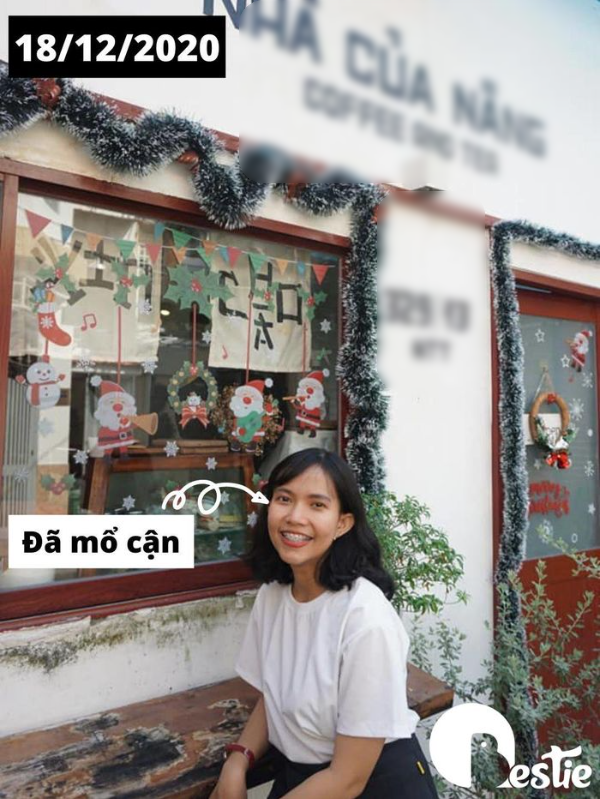 Chi 30 triệu niềng răng và 40 triệu mổ cận, cô gái lột xác ngoạn mục