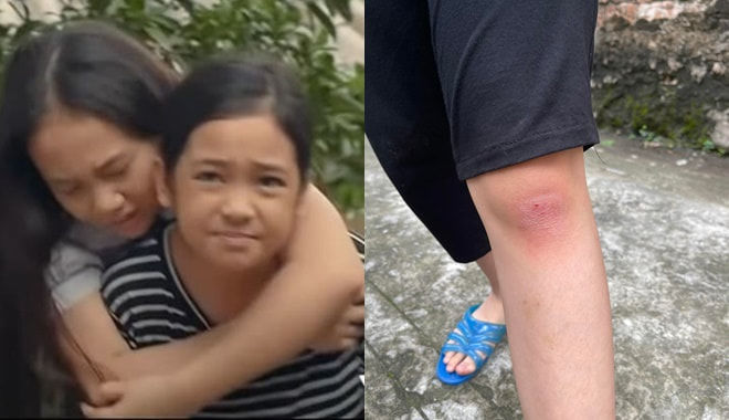 Chu Diệp Anh te tua vì vai diễn trong Thương Ngày Nắng Về