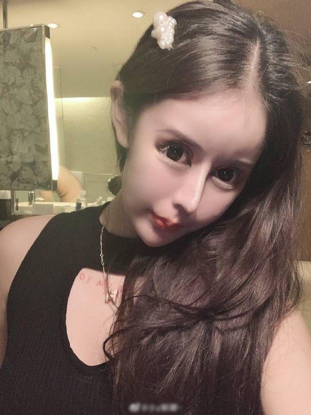 Nhan sắc hiện tại của cô gái 17 tuổi từng trải qua 60 lần thẩm mỹ