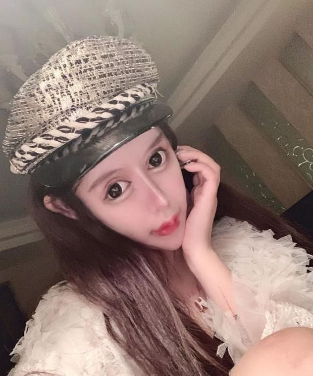 Nhan sắc hiện tại của cô gái 17 tuổi từng trải qua 60 lần thẩm mỹ