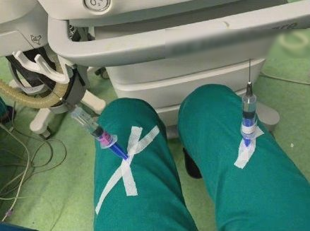 1001 ý tưởng dở khóc dở cười cho việc tránh ngồi vắt chéo chân