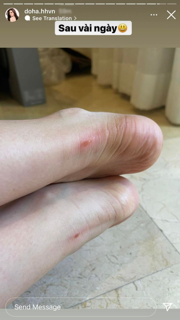Đằng sau hình ảnh người đẹp đi thi: Đỗ Thị Hà te tua đôi chân