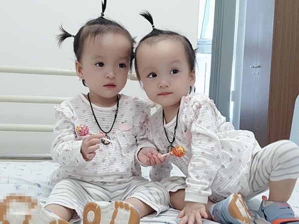 Cặp song sinh phẫu thuật tách trời hơn 1 năm trước giờ vẫn khỏe mạnh