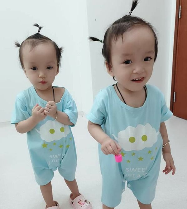 Cặp song sinh phẫu thuật tách trời hơn 1 năm trước giờ vẫn khỏe mạnh