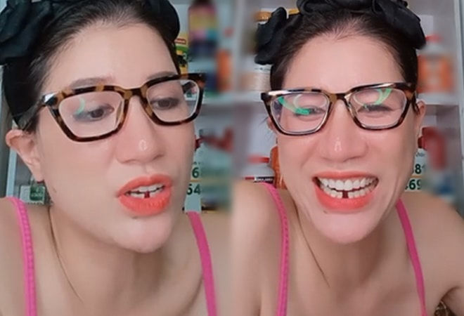 Những lần sao Việt muốn độn thổ vì răng sứ phản chủ