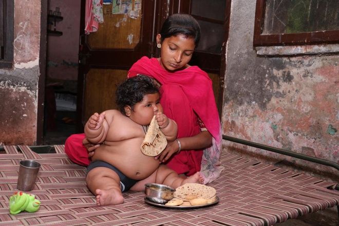 Bé trai mới 1 tuổi đã nặng 16kg, phải mặc tã người lớn mới vừa