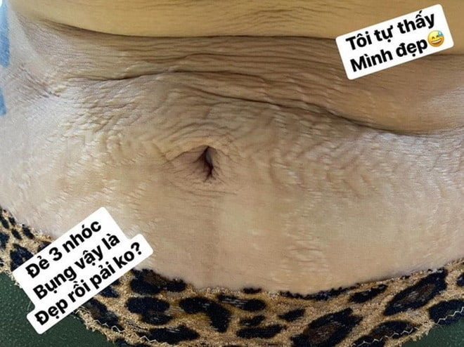 Bí quyết trị rạn da của mỹ nhân Việt: Bảo Thy bôi dầu, uống 3 lít nước