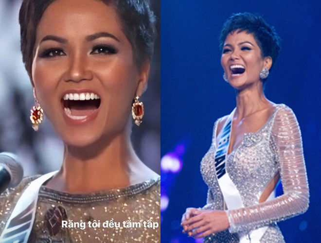 Dàn Hoa hậu tới công chuyện nhờ làm lại răng: Kim Duyên tỏa sáng