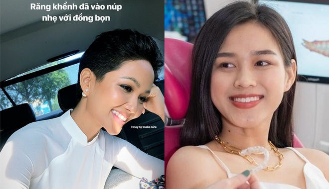 Dàn Hoa hậu tới công chuyện nhờ làm lại răng: Kim Duyên tỏa sáng