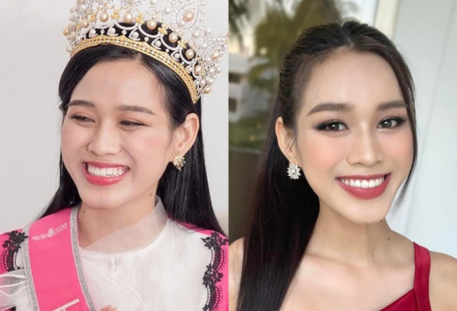 Dàn Hoa hậu tới công chuyện nhờ làm lại răng: Kim Duyên tỏa sáng