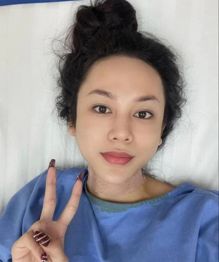 Ảnh hot sao Việt 8/1: Lương Mỹ Kỳ phẫu thuật vì áp lực dư luận