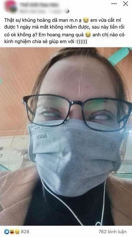 Cô gái cắt mí ăn tết hoảng hồn vì 1 ngày rồi không nhắm mắt được