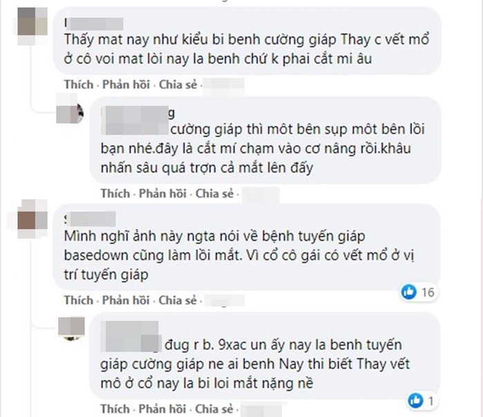 Cô gái cắt mí ăn tết hoảng hồn vì 1 ngày rồi không nhắm mắt được
