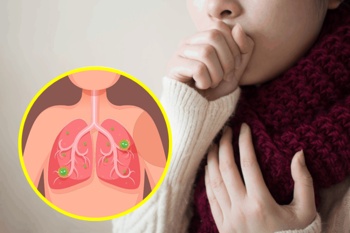 4 bài tập phục hồi chức năng phổi hậu Covid-19: Thở mím môi, thổi bóng