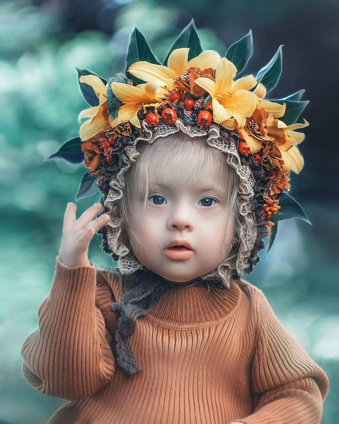 Cổ tích có thật: Phép màu đã đến với em bé mắc bệnh bẩm sinh