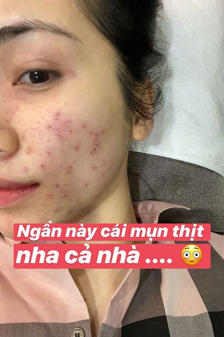 Hòa Minzy mặt mộc cân đẹp cam thường: Mẹ bỉm xinh nhất là đây