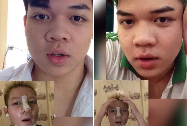 Hot TikToker bỏ 100 củ tân trang, kéo theo nhỏ bạn thân cho... đỡ sợ