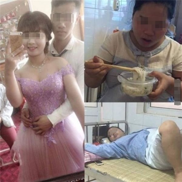 Bất ngờ nhan sắc cô gái 27 tuổi lão hóa thành bà cụ 80 hậu sinh nở