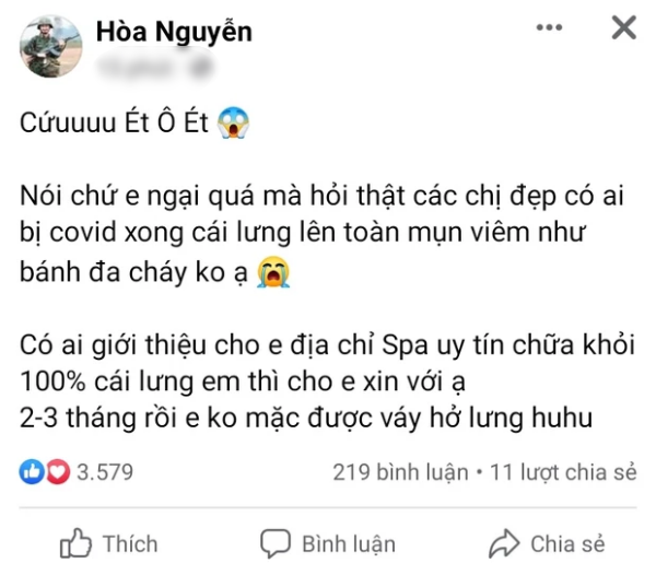 Sao nữ Vbiz khổ sở vì mụn: Hòa Minzy và H'Hen Niê chung vị trí