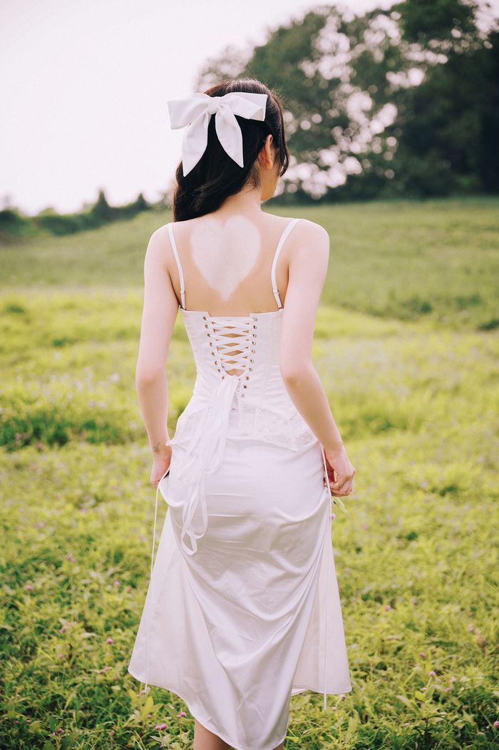 Người mẫu có làn da bạch biến đầu tiên của làng mốt Việt