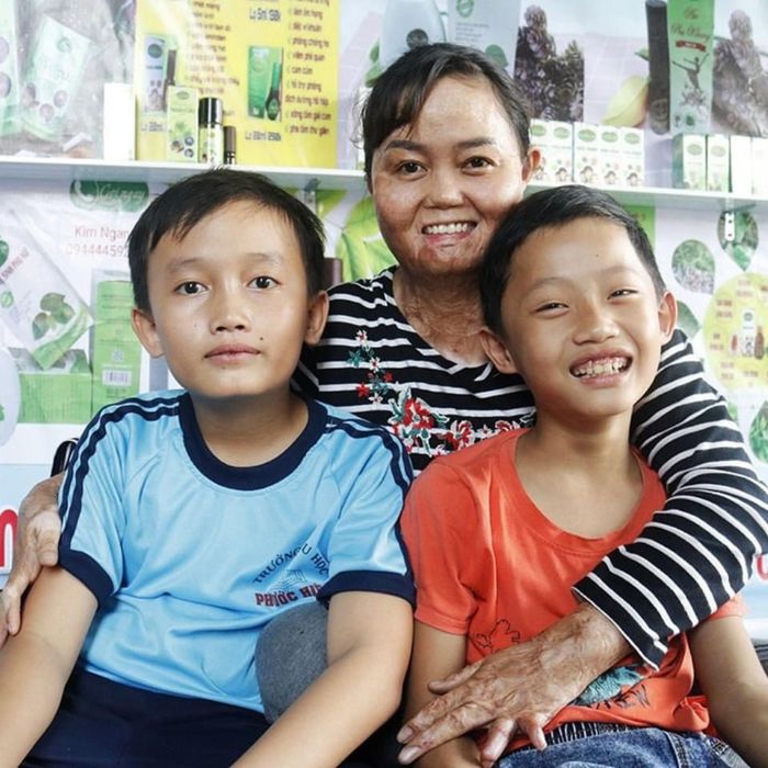 Vượt qua nỗi đau thể xác, bà mẹ hai con tìm được tình yêu đích thực
