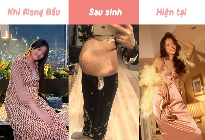 Hội những bà mẹ Vbiz tự tin khoe vết rạn: Bất ngờ với Trương Mỹ Nhân