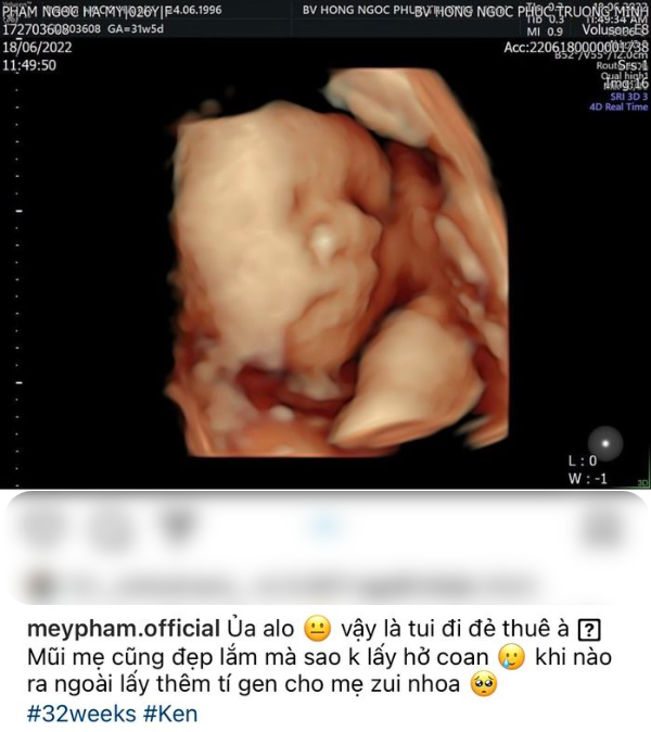 Nữ MC VTV từng được cầu hôn trên máy bay đã hạ sinh con trai đầu lòng