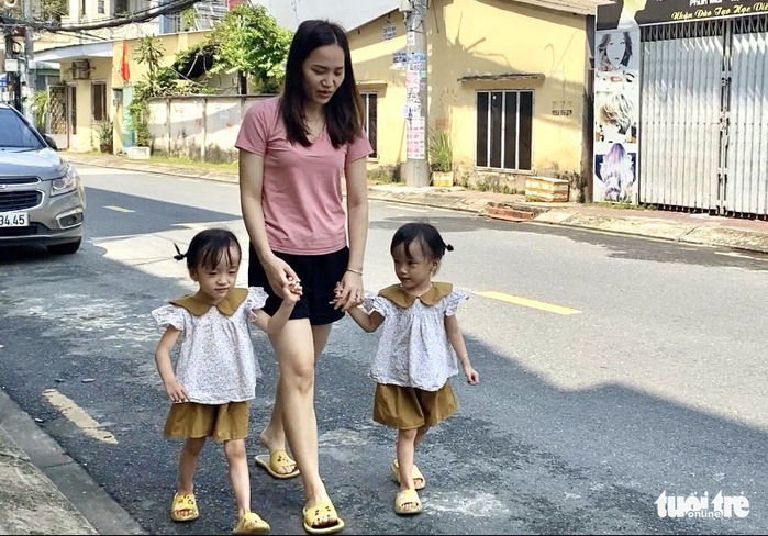 Đôi song sinh chấn động lịch sử y khoa sau 2 năm tách rời