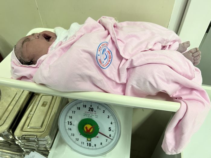 Kỳ tích: Em bé 5,1kg Thái Nguyên chào đời bằng phương pháp sinh thường