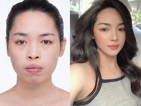 Cuộc sống của những cô gái tái sinh nhờ dao kéo, ai cũng lên hương
