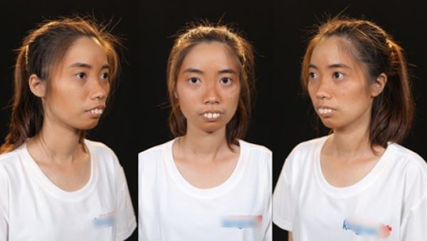 Cuộc sống của những cô gái tái sinh nhờ dao kéo, ai cũng lên hương