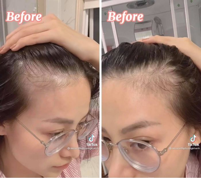 Phục hồi tóc rụng tại nhà với nguyên liệu đơn giản cùng Phương Khánh