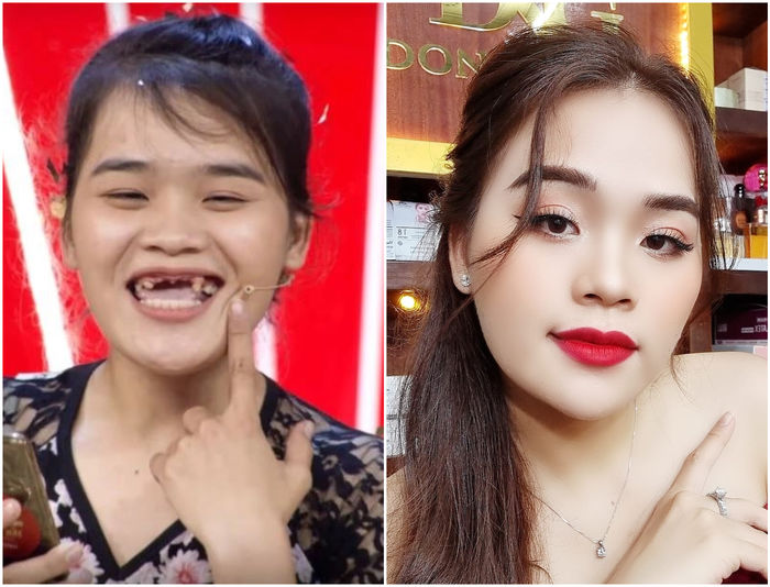 Khi các hiện tượng mạng tân trang nhan sắc: Thánh sún sửa mũi