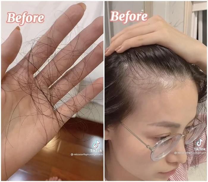 Hoa hậu Việt chăm tóc kiểu bình dân với trứng gà, nước gạo, bồ kết