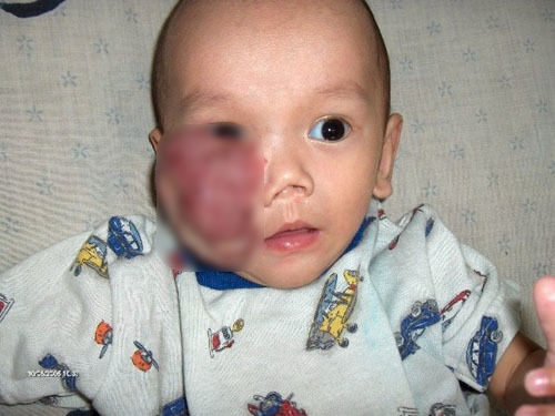 Cậu bé từng mắc u máu tìm lại bố mẹ ruột sau gần 2 thập kỷ thất lạc