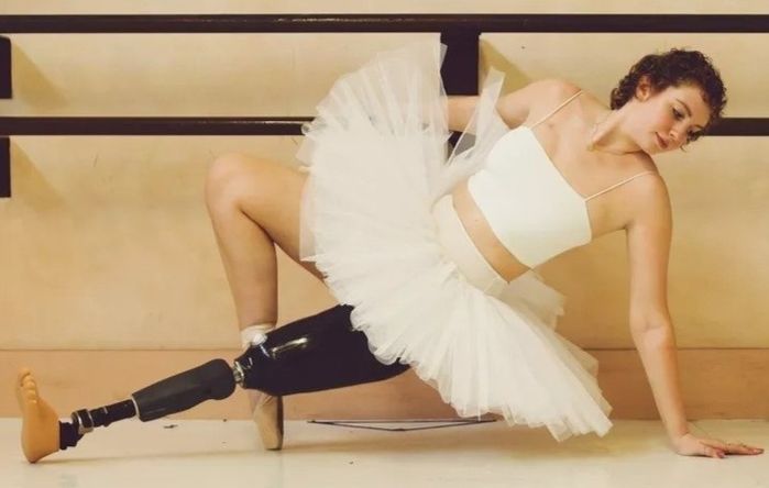 Nữ vũ công mất một chân vì bệnh nan y vẫn không dừng ước mơ nhảy múa