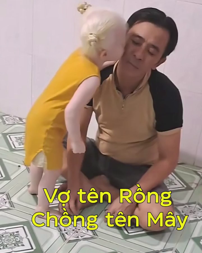 Hy hữu ở Việt Nam: chị em sinh đôi bạch tạng xinh như thiên thần