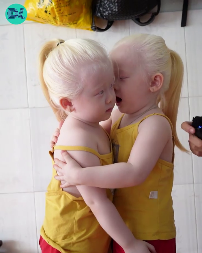 Cặp sinh đôi thiên thần tạo dáng như model: Dự thi ảnh Quốc tế