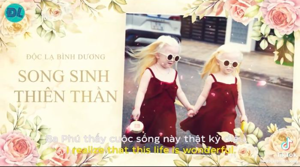 Cặp sinh đôi thiên thần tạo dáng như model: Dự thi ảnh Quốc tế