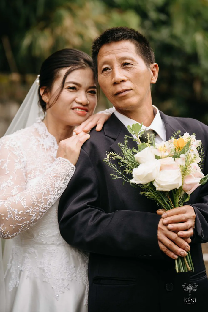 Bộ ảnh cưới ý nghĩa của cặp vợ chồng khiếm khuyết ở Hưng Yên
