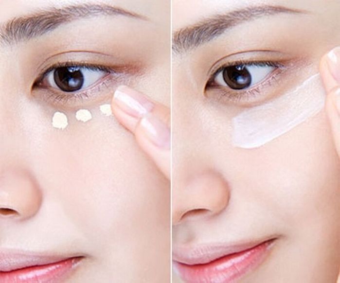 5 cách trị quầng thâm mắt siêu hiệu quả từ chuyên da làm đẹp