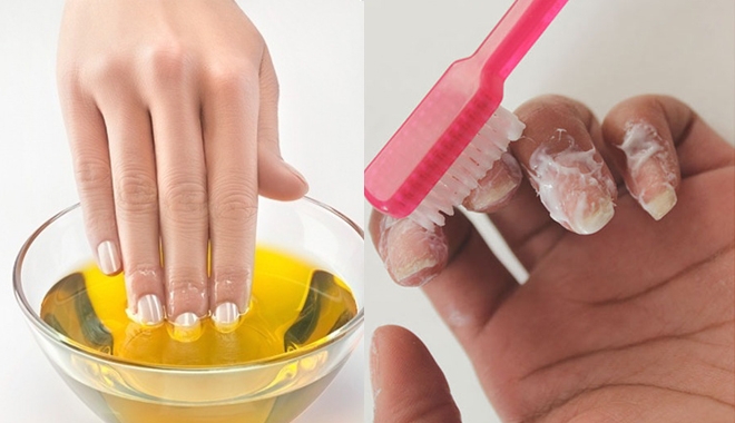 Các bước chữa móng ố vàng trong 1 tuần