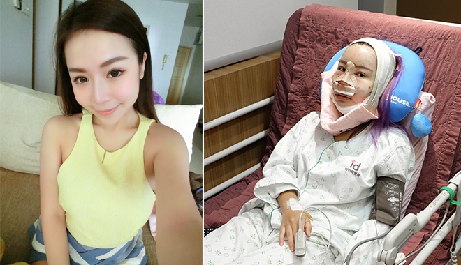 Từ A đến Z quá trình gọt cằm, nâng mũi tại Hàn Quốc của beauty blogger