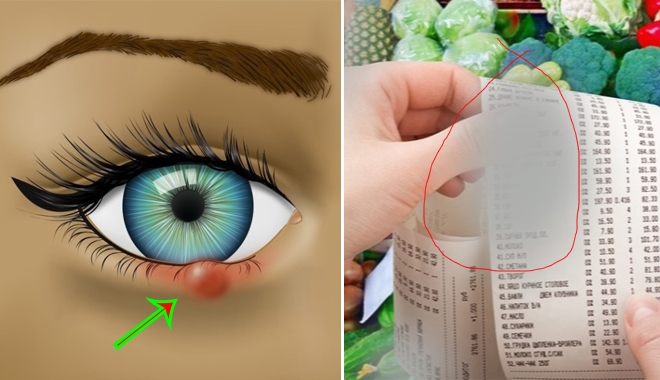 8 dấu hiệu bất thường ở mắt bạn tuyệt đối không nên chủ quan
