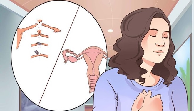 Những dấu hiệu của bệnh tắc vòi trứng khiến chị em khó có con