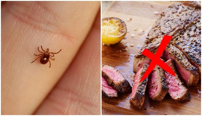 Chỉ với 1 vết cắn của loại bọ này, bạn sẽ không ăn món thịt được nữa