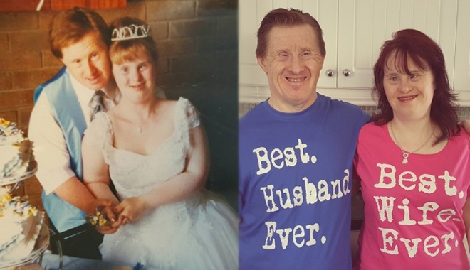 Cặp đôi đầu tiên mắc hội chứng down kết hôn & vẫn hạnh phúc sau 22 năm