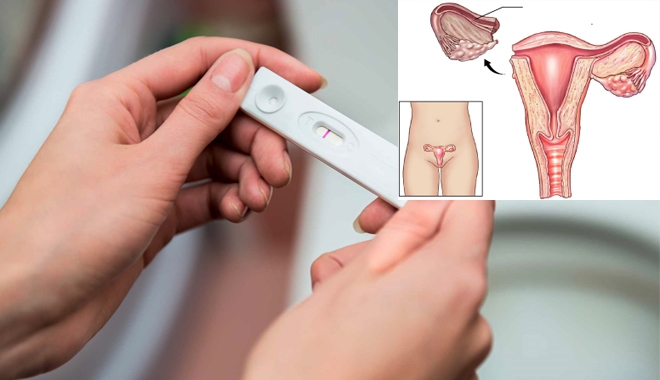 Phụ nữ có dễ thụ thai nếu bị cắt mất một buồng trứng?