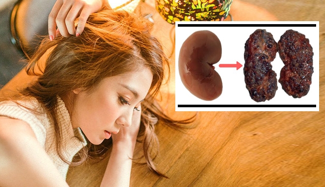 Đừng để vào viện vì 8 thói quen hỏng thận hại thân như thế này